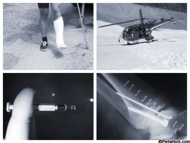 anatomy of a ski accident